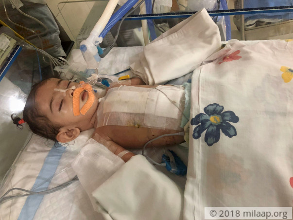 This 3-month-old baby needs an urgent heart surgery to survive