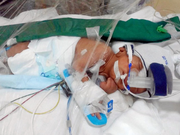 Help Punit's Pre-Term Baby