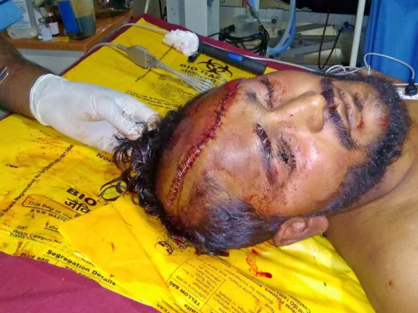 Help sourabh to Fight with head injury