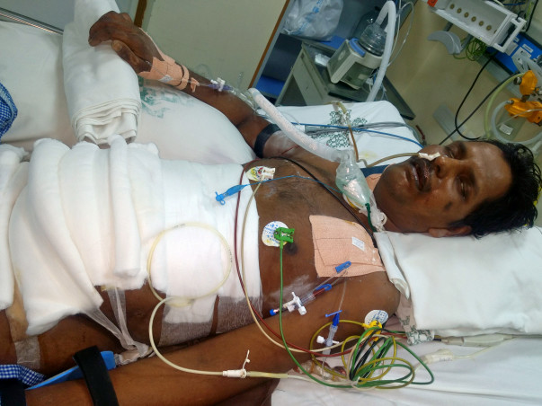 Help Balamurugan To Fight Severe Acute Pancreatitis