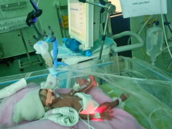 Help Me To Save My Premature Female Baby