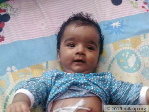 Baby of Siji Sijo needs your help to undergo treatment