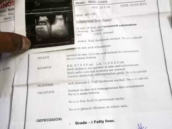 Help Me To Get Treated For Liver Treatment