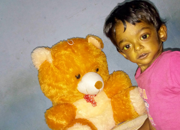LIVER TRANSPLANT for my 2yr old son Kapil Abhinav