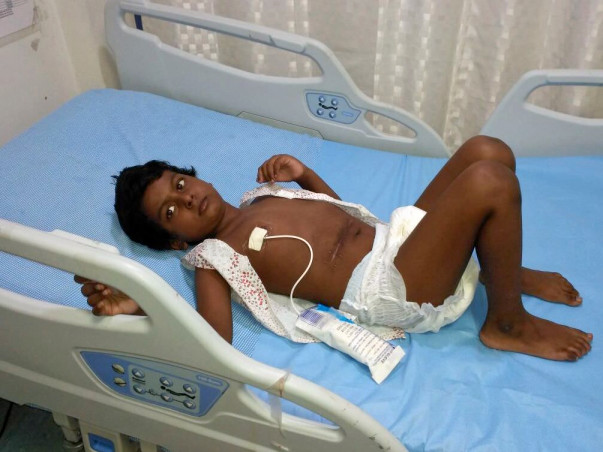 Help 4-year-old Pradyuman fight a severe stomach disease