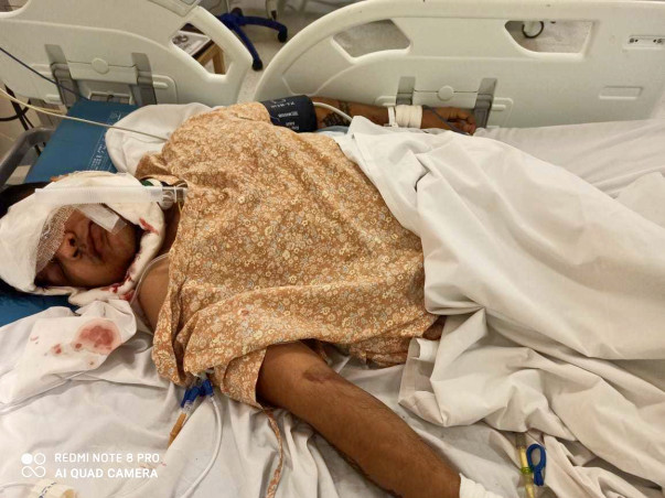Help my friend Ritesh Singh Dhanik fight Road traffic accident with polytrauma