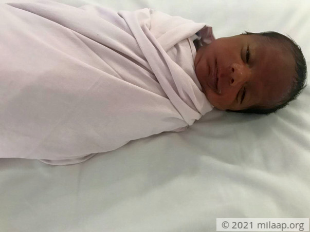 1-Month Old Born After Long Wait Will Turn Blind, Needs Urgent Help