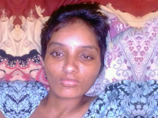 Help Swathi to fight Neuromyelitis Optica(NMO)