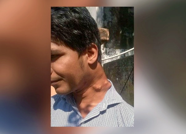 Save Rameez Khan From Paralysis