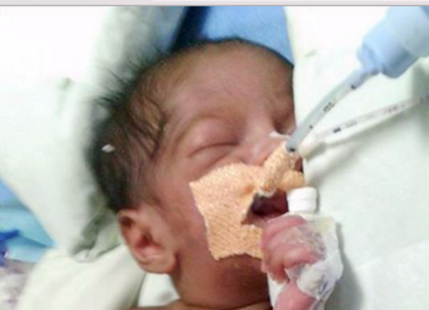 I am fundraising to Help Baby Vanshu get off the ventilator
