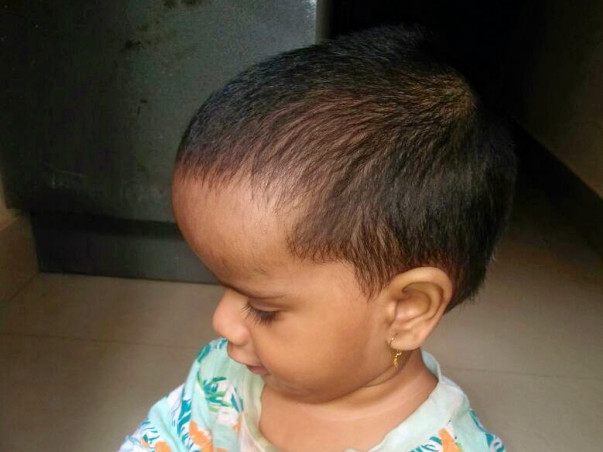 Help Ganesh Treat His Son's Hydrocephalus