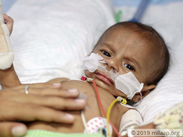 My 2 month old baby is battling for his life in the ICU