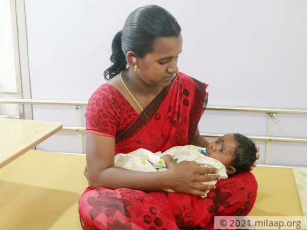 Baby of pavithra needsyour help to undergo the treatment