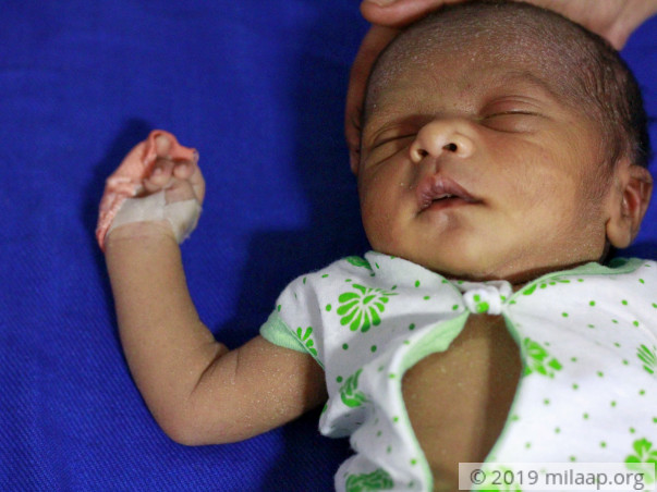 Poor Parents Cannot Afford Baby Boy's Urgent Heart Surgery