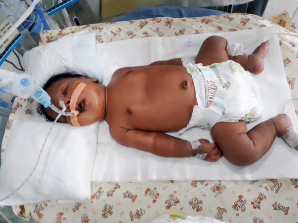 Sujatha's 1-month-old baby is suffering from Pneumonia and needs help