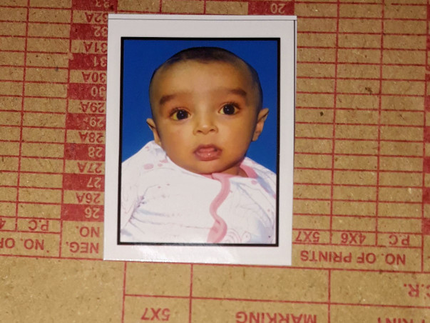 Help 6-month-old Hashir Undergo A Liver Transplant
