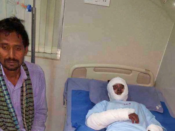 Help Poor Burn Victims from Jharkhand