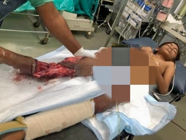 Help Little Harsha to Walk Again