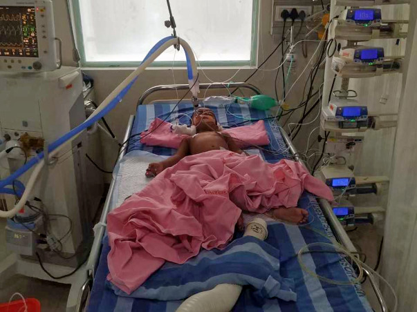 Help 2-year-old, JASHWIK for his lung infection treatment