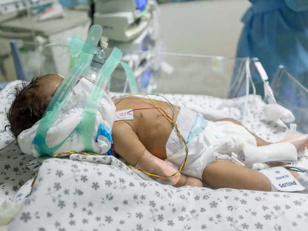 Help this 1-month-old boy who is fighting for his life