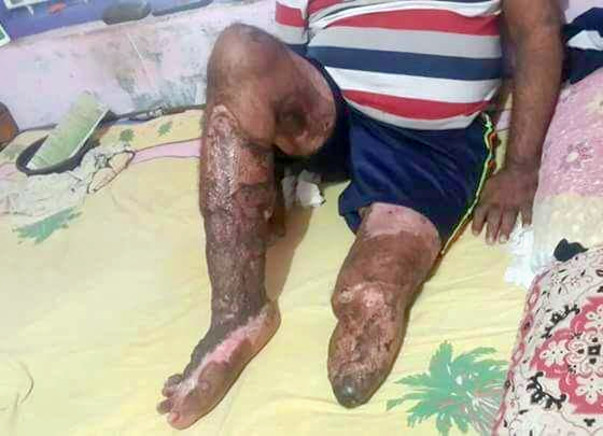 Help the Only Breadwinner of the Family Get Back On His Feet Again