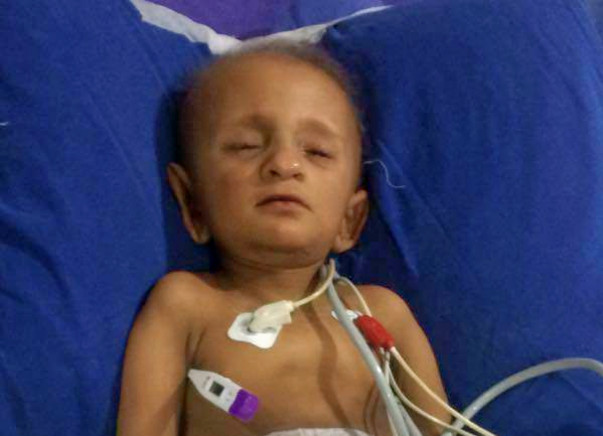 My 2 year 0ld son suffering from kidney cancer