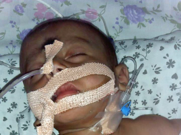 Help 6 Month Old Bikshapathi Fight with Pneumonia
