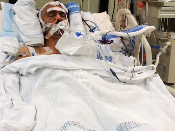 Help for my father's Brain Stroke