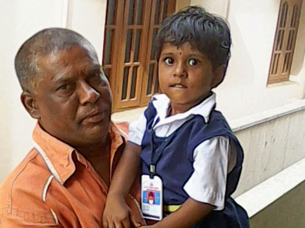 45% Of This Little Girls Body Is Burnt, She Needs Our Help