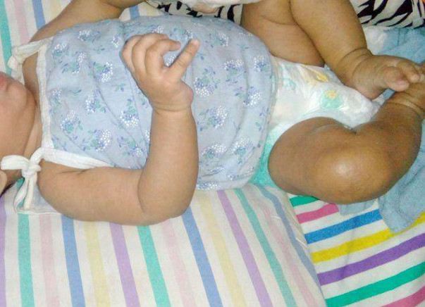 Help Save The Life Of My 8-month-old Daughter