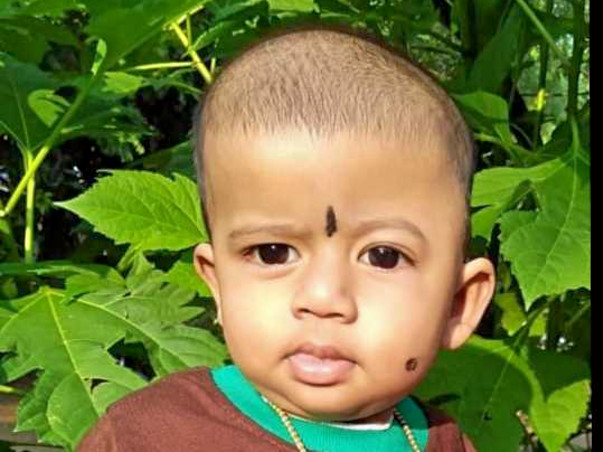 Baby Athira needs Craniosynostosis Treatment. Please help!