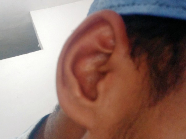 Help Me For My Ear Operation