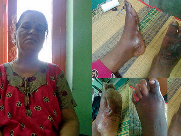 Help My Mother and make her to walk again