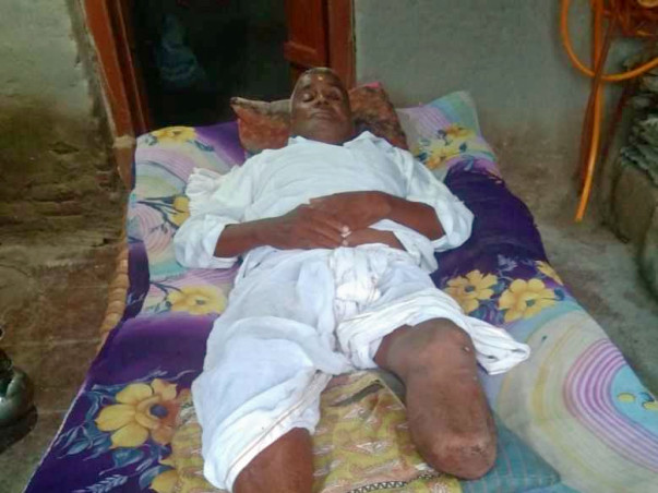 Help My Grandfather Undergo Surgery