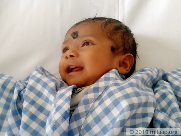 Save This 2-month-old Baby Who Has 2 Large Holes In Her Heart