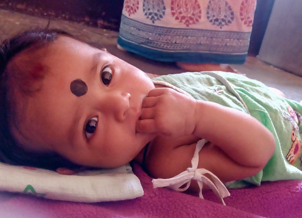 Help little Dimple for her treatment