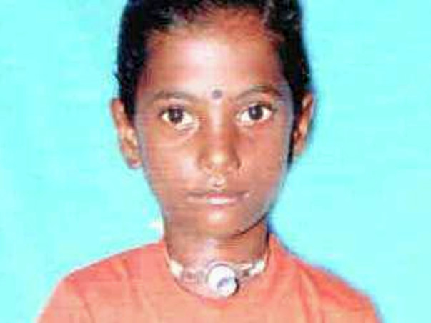 Help Sangeetha to recover from Severe Grade IV Subglotic Stenosis