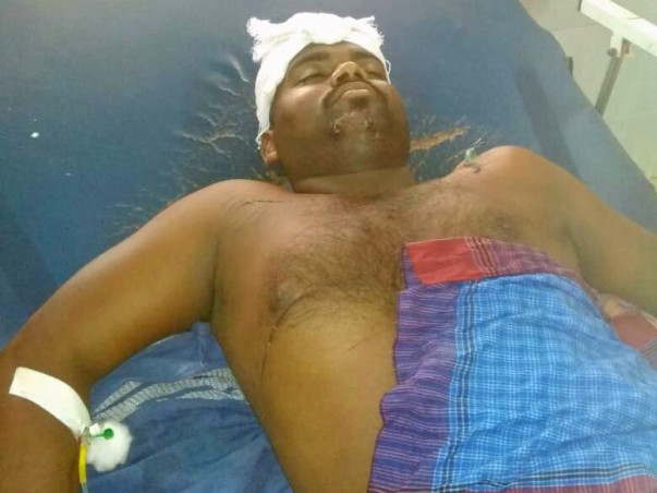 Fund Raising For Manikandan Brain Surgery