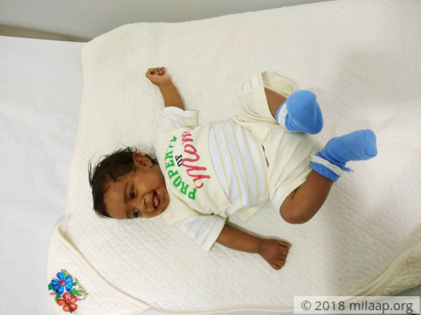 This 4 month old baby needs a liver transplant to survive
