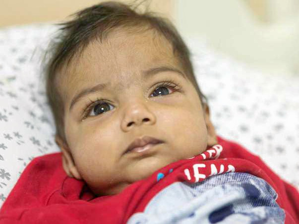 This 6-month-old baby boy is fighting a severe liver disease