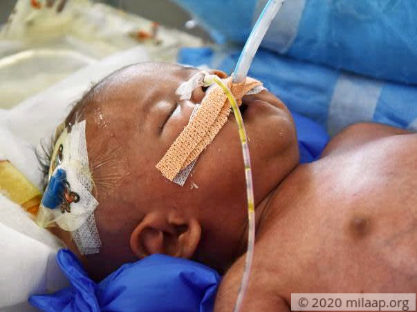 Help Ambika save her premature baby