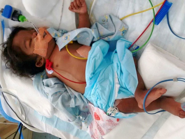 This 5-Month-Old Baby Needs Your Urgent Support To Stay Alive