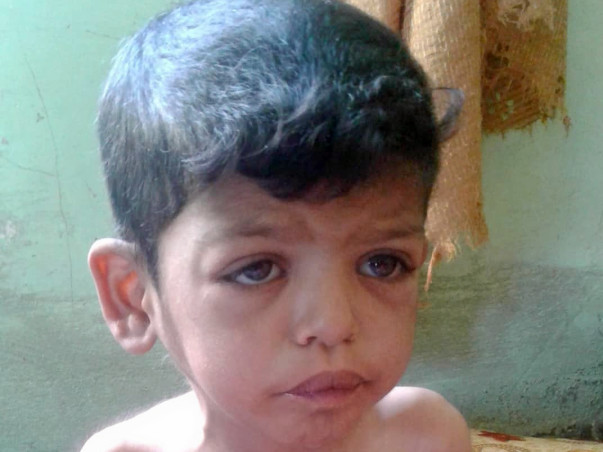 Help War Torn Baby Yunus Undergo A Life Saving Heart Surgery