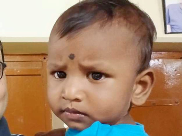 Help 1.6 Years Old Kid Praneeth Undergo Open Heart Surgery