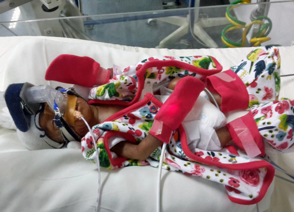 Help New Born Baby Fight A Respiratory Infection