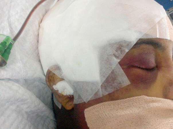 Help Kiran Fight Cancer