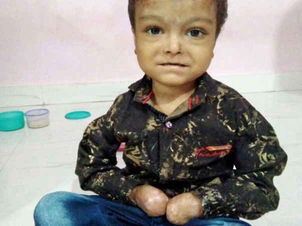 Help 7-year-old Fight Rare Disease