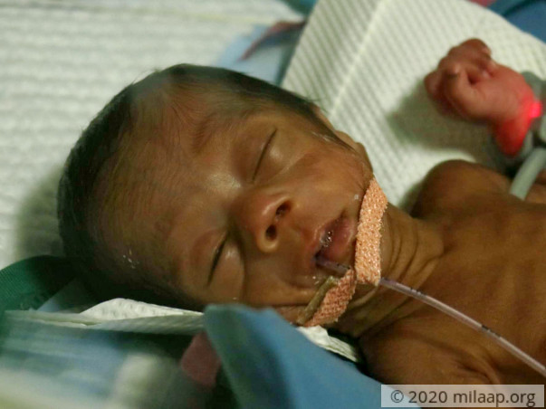 Help Our Twin Babies Recover