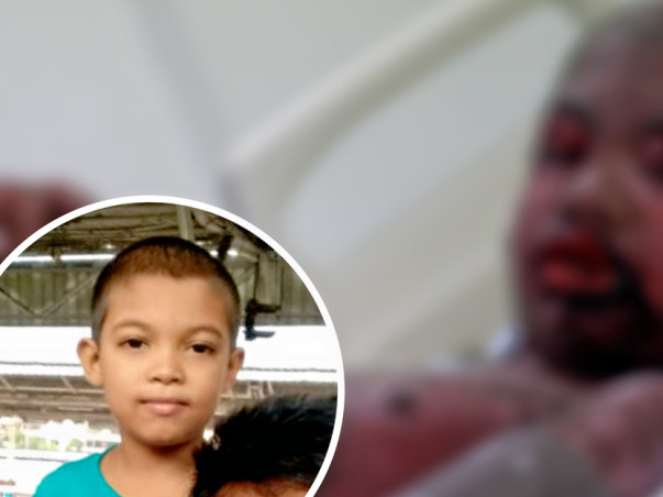 Help Saif Iqbal to fight against Graft versus host disease