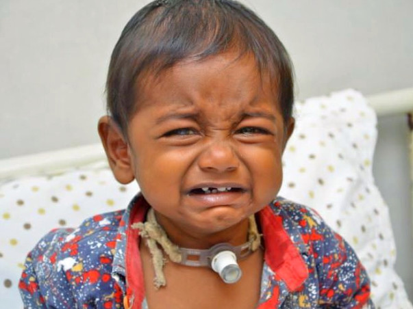 1-year-old Joel Has A Blocked Windpipe & He Needs A Surgery To Breathe
